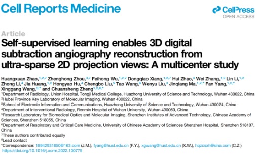 New Progress made in 3D-DSA Reconstruction Research by Professor ZHENG Chuansheng’s Team